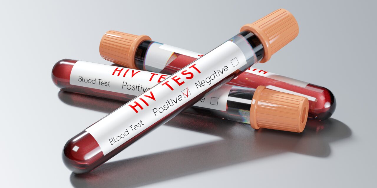 KONKURS Z OKAZJI ŚWIATOWEGO DNIA AIDS